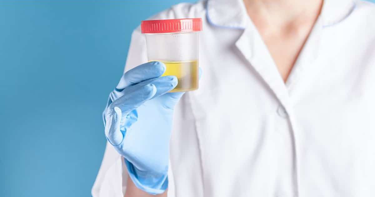 Farmacia_del_Porto_Bologna_Servizi_analisi-urine